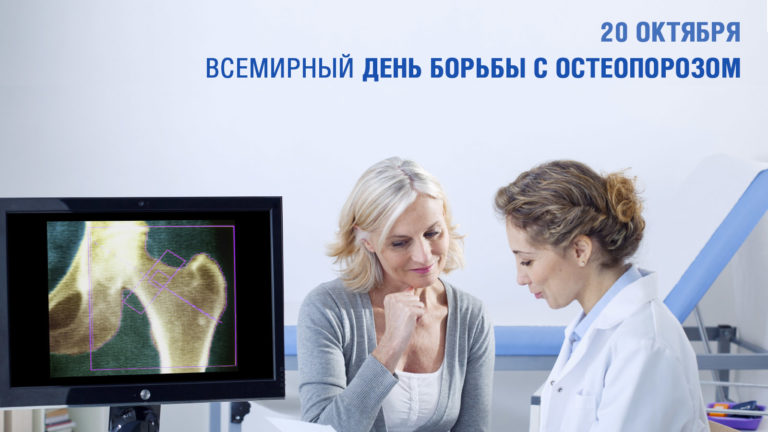 Всемирный день борьбы с остеопорозом. Каковы шансы на победу?